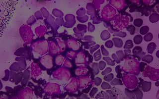 Discover how healthy cells protect you from chronic diseases & fatigue