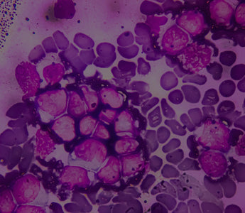 Discover how healthy cells protect you from chronic diseases & fatigue